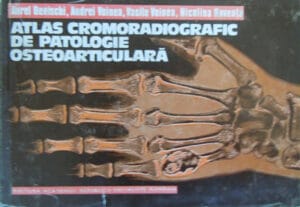 Atlas cromoradiografic de patologie osteoarticulara (Aurel Denischi, Andrei Voinea, Vasile Voinea, Nicolina Roventa)