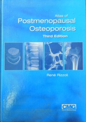Atlas of postmenopausal osteoporosis / Atlas de osteoporaza postmenopauza - third edition (Rene Rizzoli)
