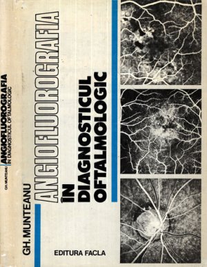 Angiofluorografia in diagnosticul oftalmologic (Gh. Munteanu)