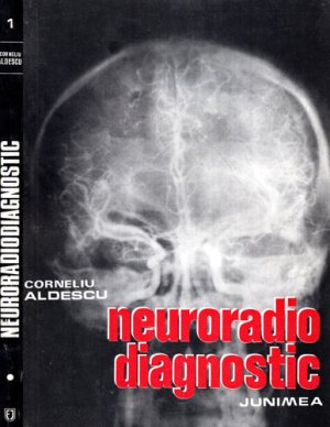 Neuroradio diagnostic - neurologie vol. I (Corneliu Aldescu)