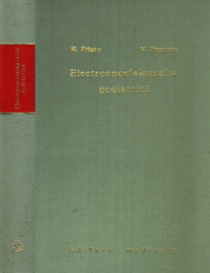 Electroencefalografia pediatrica (Razvan Priscu, Valeriu Popescu)